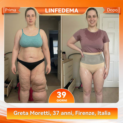 💝𝑁𝑒𝑔𝑜𝑧𝑖𝑜 𝑈𝑓𝑓𝑖𝑐𝑖𝑎𝑙𝑒 𝑑𝑒𝑙 𝐵𝑟𝑎𝑛𝑑 | ✅𝑃𝐴𝑈𝑅𝐴𝐽𝑈® 2026 𝑆ℎ𝑜𝑟𝑡𝑠 𝑀𝑜𝑑𝑒𝑙𝑙𝑎𝑛𝑡𝑖 𝑒 𝐵𝑟𝑢𝑐𝑖𝑎-𝐺𝑟𝑎𝑠𝑠𝑖 4-𝑖𝑛-1 𝑐𝑜𝑛 𝑀𝑜𝑟𝑖𝑛𝑔𝑎 𝑒 𝐵𝑒𝑟𝑏𝑒𝑟𝑖𝑛𝑎 𝑎 𝑀𝑖𝑐𝑟𝑜𝑝𝑎𝑟𝑡𝑖𝑐𝑒𝑙𝑙𝑒