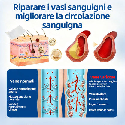 ✅𝐅𝐥𝐨𝐫𝐢𝐬𝐦𝐚® 🦙🩸𝐎𝐛𝐢𝐞𝐭𝐭𝐢𝐯𝐨 𝐕𝐞𝐧𝐨𝐬𝐨 𝐂𝐞𝐫𝐨𝐭𝐭𝐨 𝐂𝐨𝐧 𝐌𝐢𝐜𝐫𝐨𝐚𝐠𝐡𝐢⚡Sollievo immediato, risultati a lungo termine
