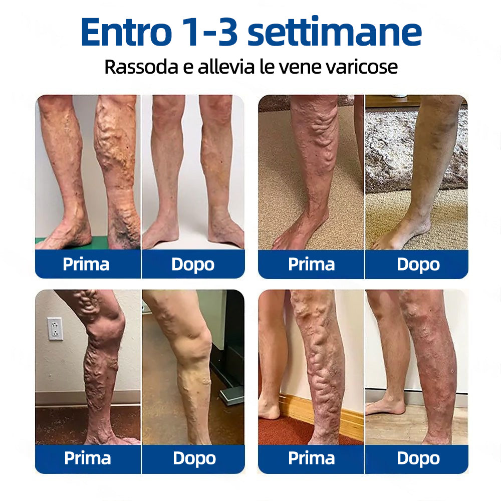 ✅𝐅𝐥𝐨𝐫𝐢𝐬𝐦𝐚® 🦙🩸𝐎𝐛𝐢𝐞𝐭𝐭𝐢𝐯𝐨 𝐕𝐞𝐧𝐨𝐬𝐨 𝐂𝐞𝐫𝐨𝐭𝐭𝐨 𝐂𝐨𝐧 𝐌𝐢𝐜𝐫𝐨𝐚𝐠𝐡𝐢⚡Sollievo immediato, risultati a lungo termine