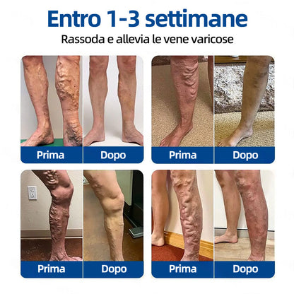 ✅𝐅𝐥𝐨𝐫𝐢𝐬𝐦𝐚® 🦙🩸𝐎𝐛𝐢𝐞𝐭𝐭𝐢𝐯𝐨 𝐕𝐞𝐧𝐨𝐬𝐨 𝐂𝐞𝐫𝐨𝐭𝐭𝐨 𝐂𝐨𝐧 𝐌𝐢𝐜𝐫𝐨𝐚𝐠𝐡𝐢⚡Sollievo immediato, risultati a lungo termine
