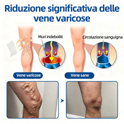 ✅𝐅𝐥𝐨𝐫𝐢𝐬𝐦𝐚® 🦙🩸𝐎𝐛𝐢𝐞𝐭𝐭𝐢𝐯𝐨 𝐕𝐞𝐧𝐨𝐬𝐨 𝐂𝐞𝐫𝐨𝐭𝐭𝐨 𝐂𝐨𝐧 𝐌𝐢𝐜𝐫𝐨𝐚𝐠𝐡𝐢⚡Sollievo immediato, risultati a lungo termine